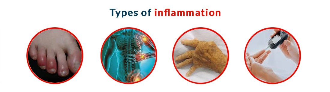 Types of Inflammation